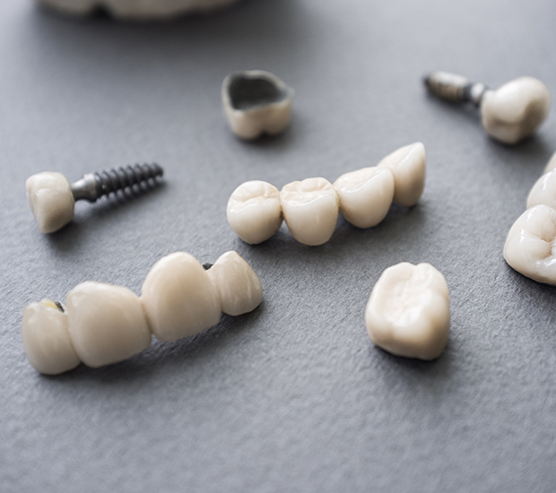 Middle Island The Difference Between Dental Implants and Mini Dental Implants
