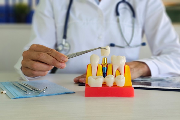 Periodontics: What Is Crown Lengthening?