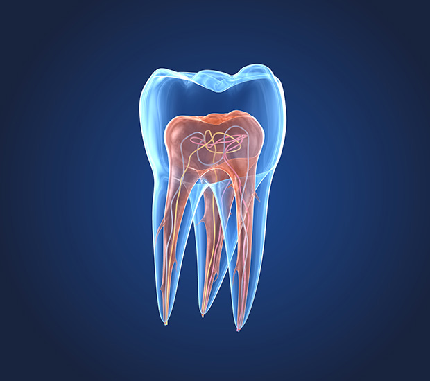 Middle Island What is an Endodontist